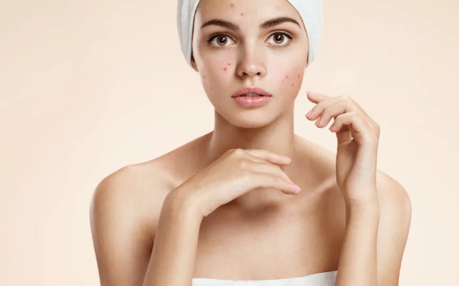 雅双国际教你春季护肤攻略,一定要做娇嫩嫩的小仙女!_皮肤