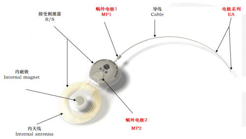 成人语后聋可获得免费人工耳蜗安装还有15万元救助费