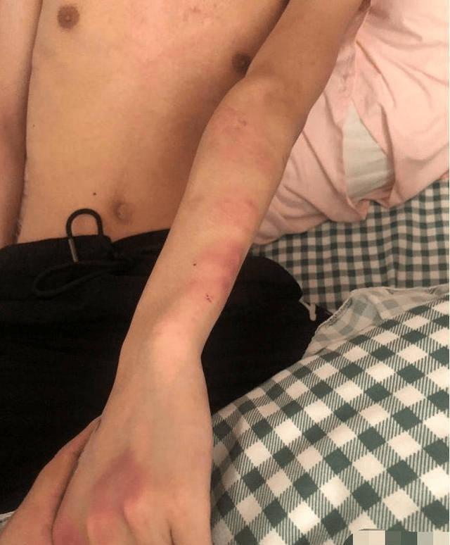 原创
男朋友喝醉酒把我家砸了,我把他打了一顿,是不是太过分了?