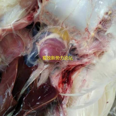 灶性坏死,有神经症状的,脑部局部液化坏死,水肿,脑膜血管增生呈树枝样