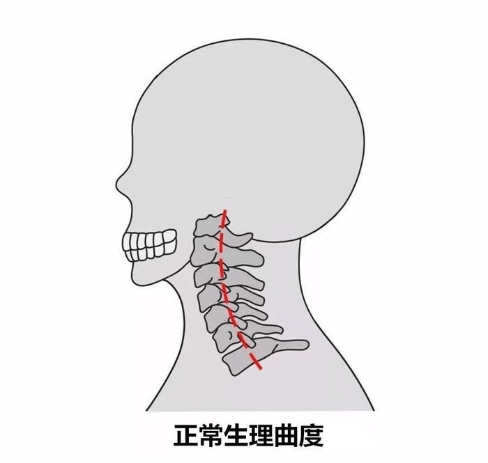 美女十年不枕枕頭,本意預防駝背,沒想到頸椎卻遭了罪_陳小姐