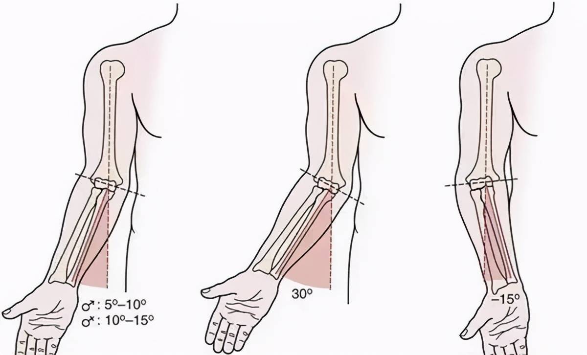 據歐陽元明介紹,正常人掌心向前,使肘關節保持自然伸直時,前臂軸線與