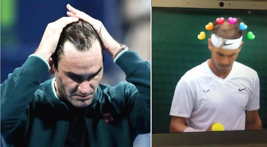 纳达尔:看来我花那么多钱的植发还是失败了.