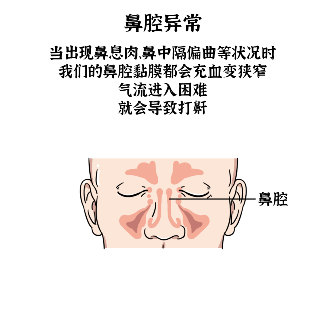 e1c4a11fb7034cbeb981f58e92c942f1.png