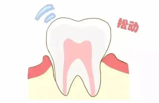 松牙修复不及时,危害颇深当前,很多中老年人出现牙齿松动后没有及时
