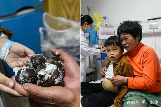河南7岁男孩患重病肚子肿大如球,父亲:不想放弃孩子