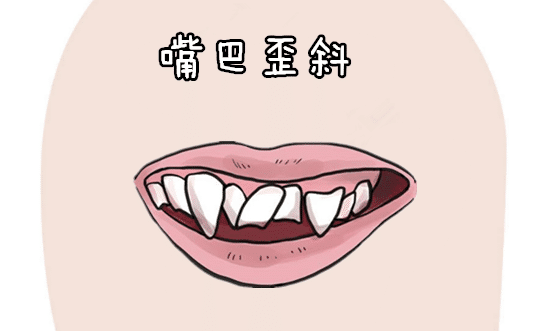 嘴弄舌什么成语_最大的嘴的成语是什么