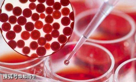 正确补充 抗氧化之王 虾青素 给你一个意想不到的变化 人体