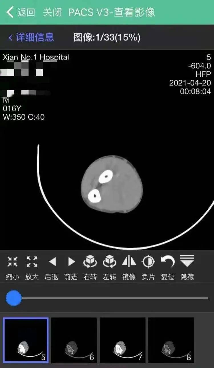 影像|西安市第一医院云影像来喽~告别纸质报告，手机绑定信息就能查看报告！