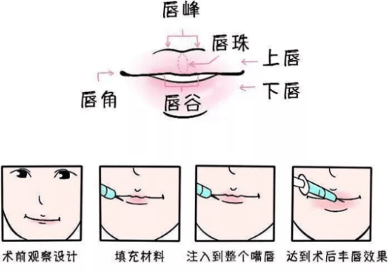 bcccb26fb464433eb08c586fa9a4fd8a.png