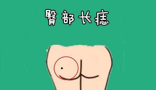 原创身上5颗黄金痣个个财大气粗一个比一个值钱福禄寿全