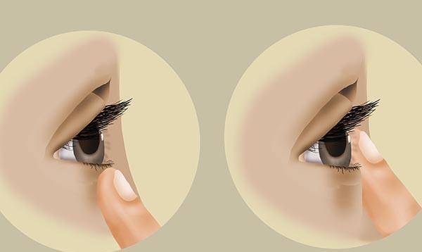 如何正常消除黑眼圈 381ad0a3c270447cb6c1be74a1ef9936.jpeg