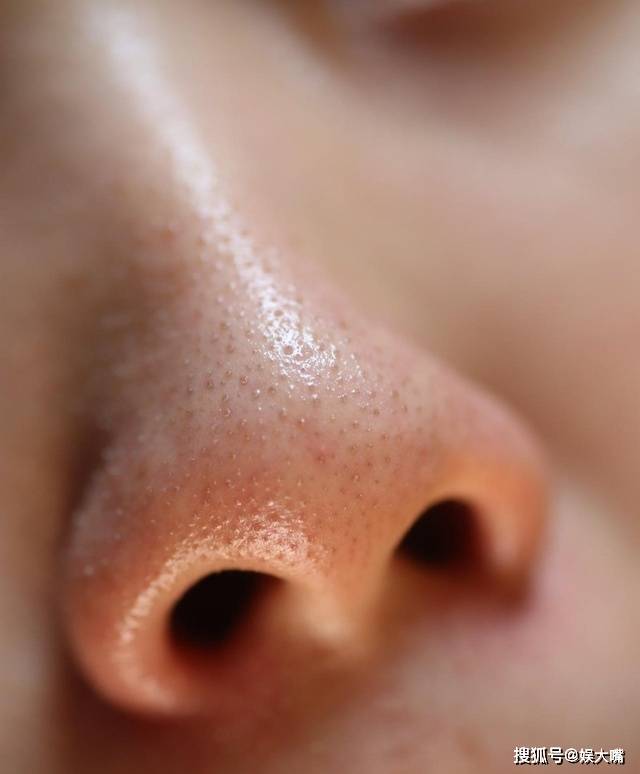 草莓像黑鼻头？林峯的这个比喻黑了草莓一家！强迫症勿进