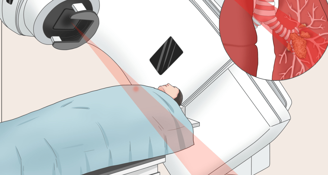 放疗血项那些事儿