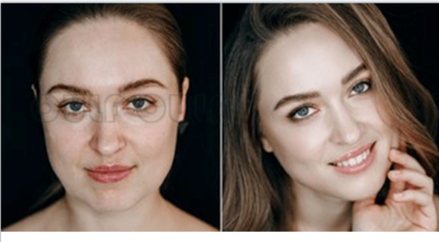 能量|大揭秘、热玛吉和超声刀的区别、千万不要选错呀~