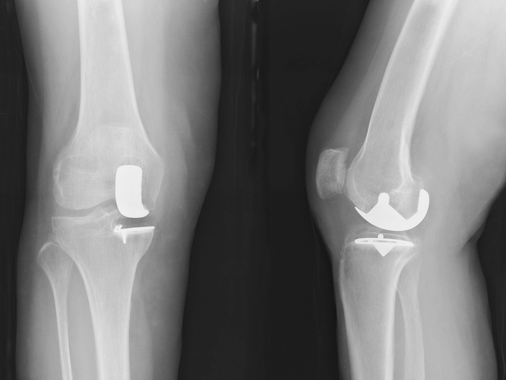 e5fa55a76d49477b99130be1631896e2.jpeg