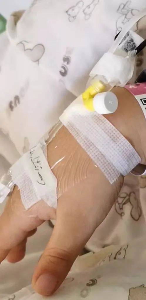 我一直没有勇气去拿留针用物,看着哭得满头大汗的娃止不住地心疼.