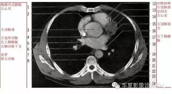 收藏!超詳盡的心臟大血管影像示意圖及肺部解剖與影像分段