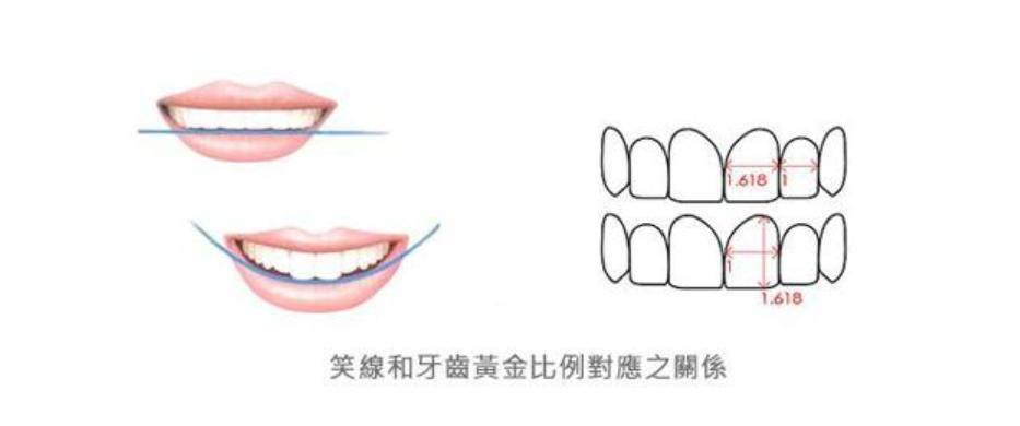 原創範芳醫生談牙齒美學標準