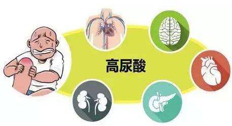 什么时候检查尿酸最好 98d852fb1d6e47a7b494d4ca5789ec9f.jpeg