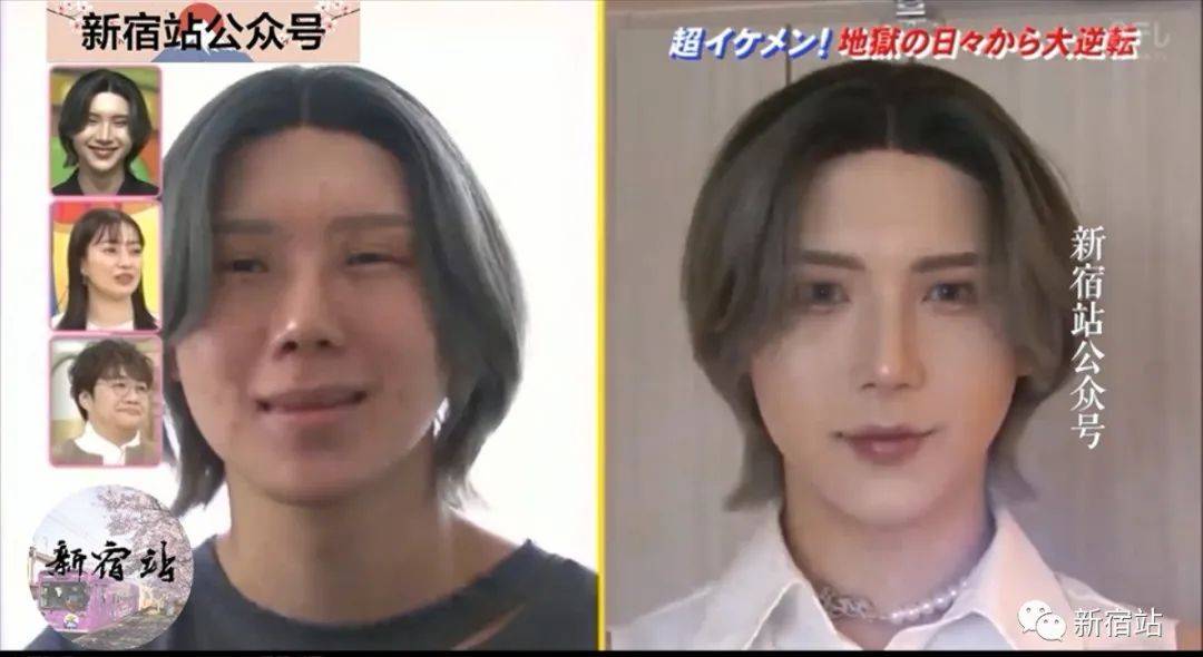 18岁掉光头发 几度想过自杀 后因学会 化妆 而重新站起来的日本型男 脱毛