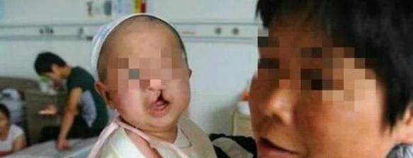 小丹|女儿出生后是兔唇，宝妈谎称因孕期吃太多兔头，医生当场揭穿谎言