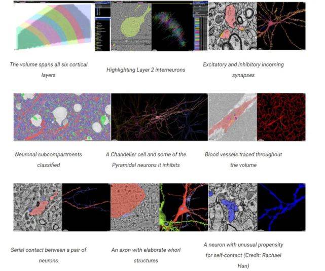成像|1.3亿突触、数万神经元，谷歌、哈佛发布史上最强三维人脑地图