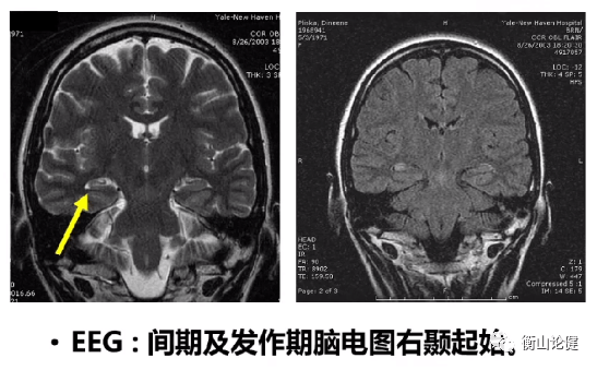 孩子突然意識喪失千萬別不當回事因為