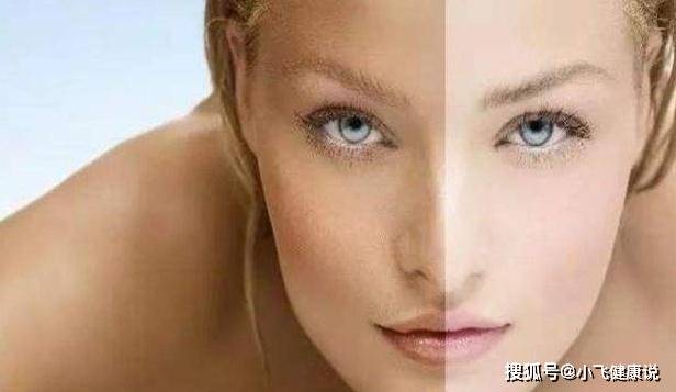 女人皮肤发黄是怎么回事？做好这件事或许帮你缓解，看看吧