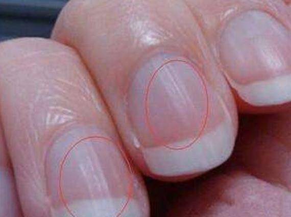 手掌是肝脏的"晴雨表",若出现3大迹象,肝脏或已"稀烂"