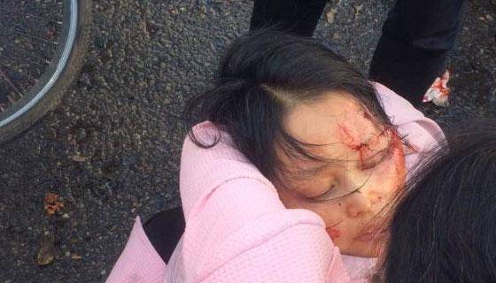 妹妹被妹夫刺中腹部, 哥哥为保护妹妹用铁锹拍死妹夫, 被判刑3年