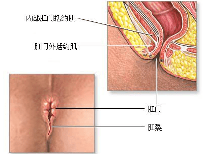 扛裂怎么办