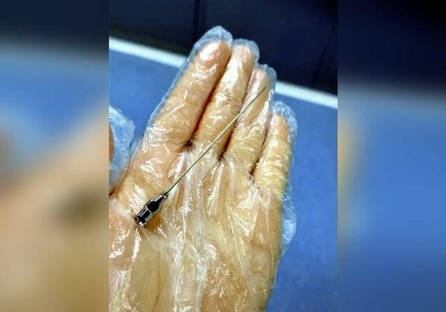 原创剖宫产真的那么简单吗?看看这场手术用到的工具,让人不寒而栗