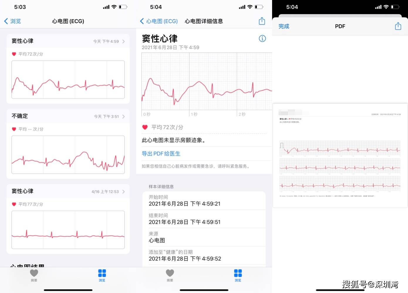 心电图|苹果拿到国家药监局的认证，但国行 Apple Watch 推行 ECG 道阻且长