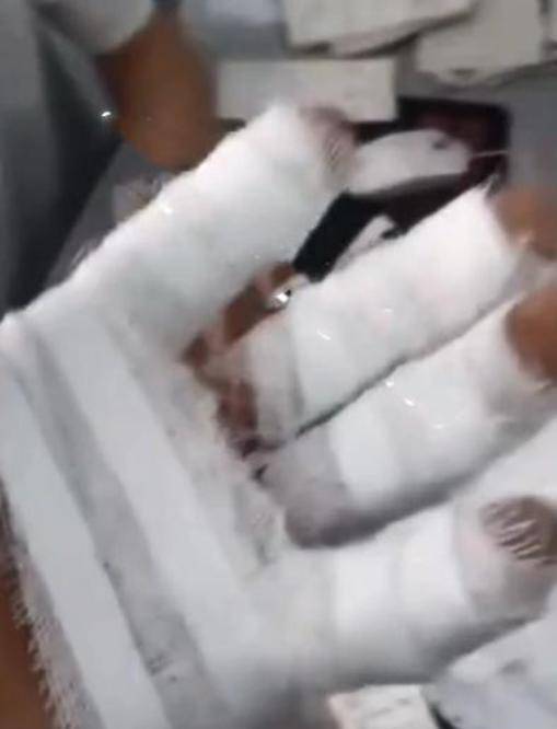  二驴夫妇真摊上事：售卖的山寨机发生爆炸 炸伤消费者(图5)