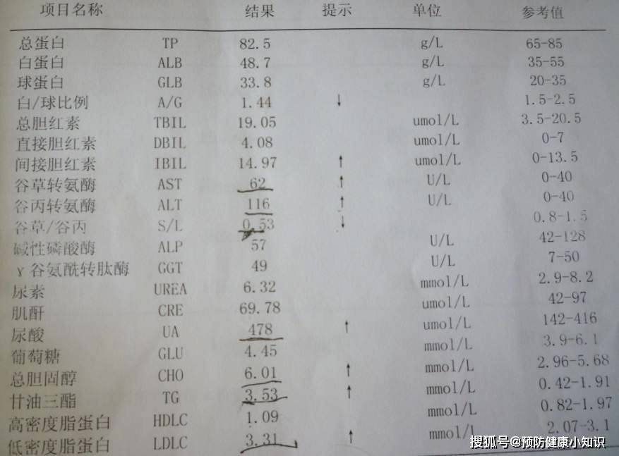 很多肝炎患者总是会去定期检查,但是检查结果出来,却完全不会看了