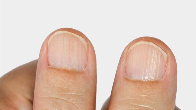 上半身|肝不好的人,上半身藏不住,出现这4种标志,尽快检查肝功能