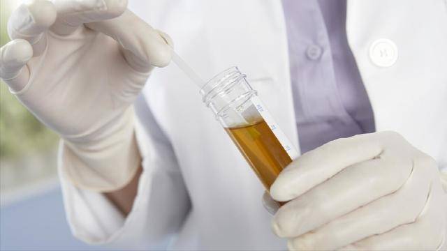 上半身|肝不好的人,上半身藏不住,出现这4种标志,尽快检查肝功能