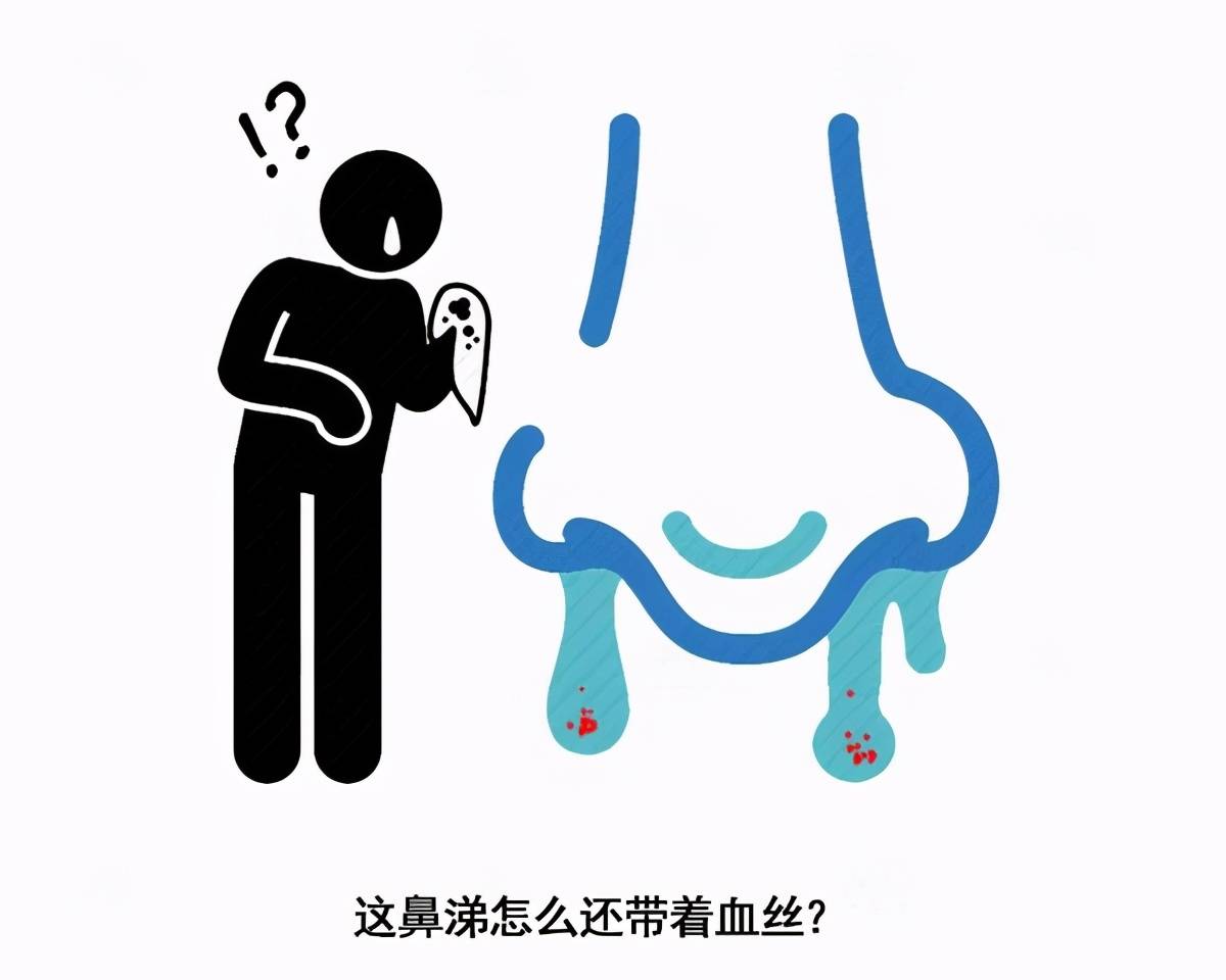 原创
世界过敏性疾病日:这种病不致命,但发作起来却让人生不如死