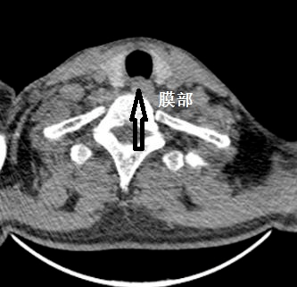 a03aa73c65f04706b3bdeacb2ef1eb25.png