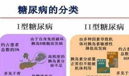 种类|糖尿病人能不能喝酒?这7种情况应禁止饮酒,满足7点可少量饮酒!
