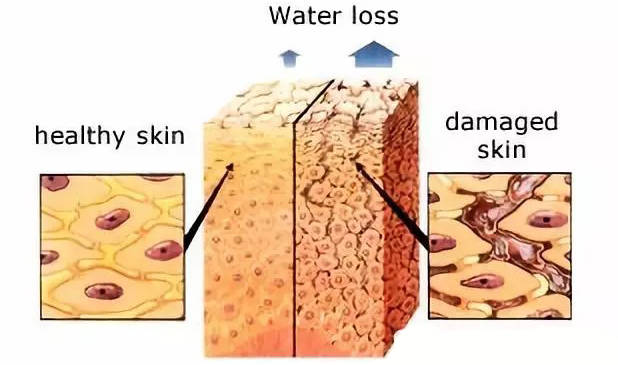 方法|moodrose护肤课丨冬季皮肤突然紧绷、瘙痒、粗糙、刺痛，用这 3 招秒治！