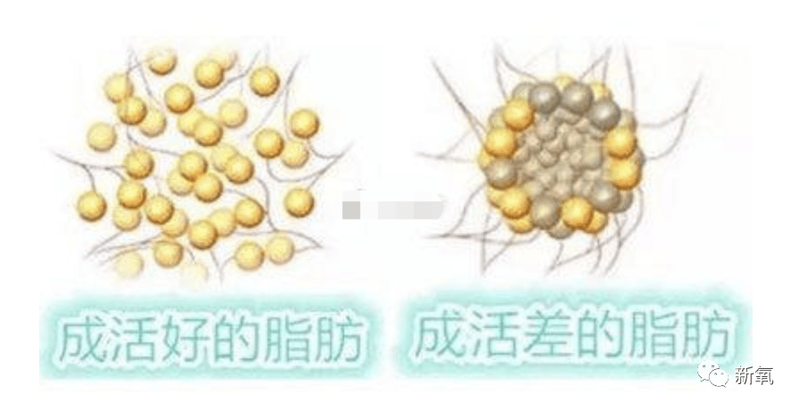 因为|和渣男分手后再出现的阚清子太好看了吧！脸小一整圈！