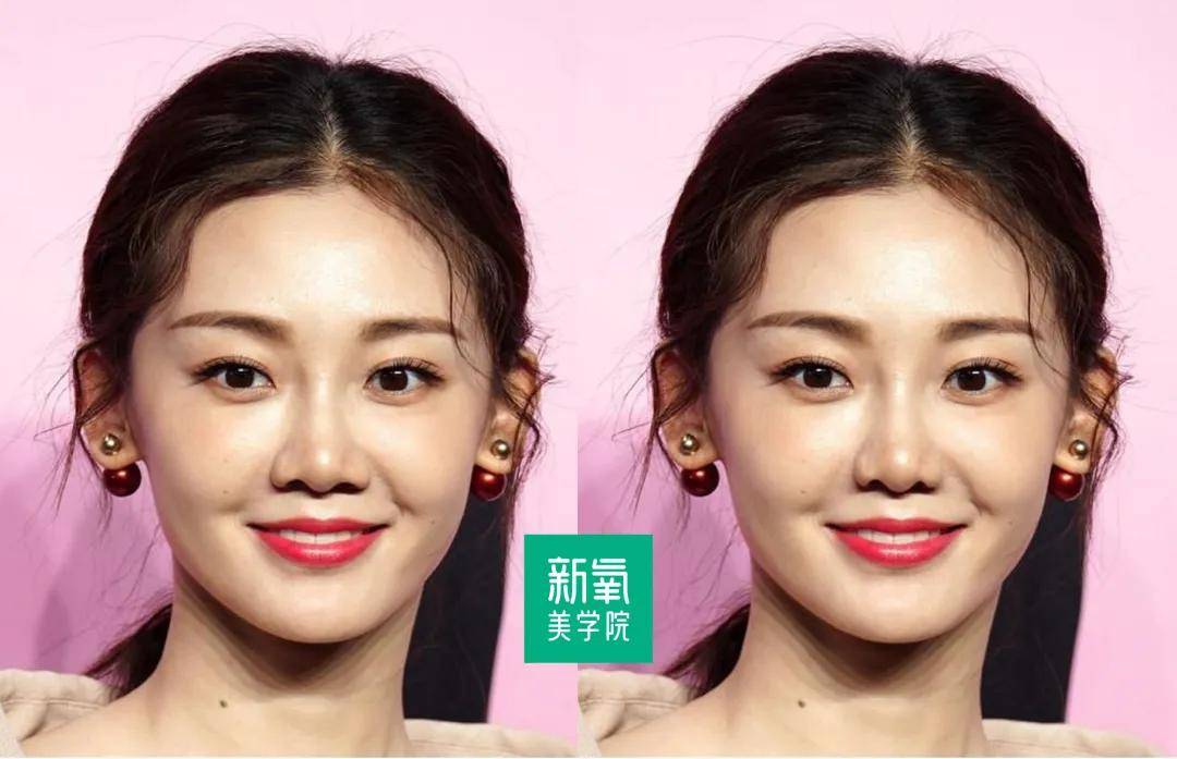 问题|给中年李嘉欣换上刘亦菲同款肉鼻头，会变什么样？