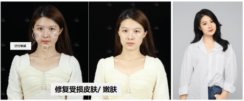 治疗|青春创造营活力开营！美莱五美实力演绎就敢这么美！