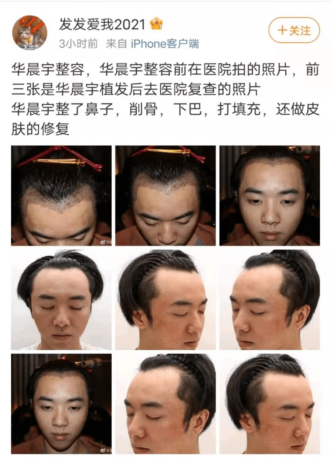 ede5c323708b442b900f9341ede14e2c.png