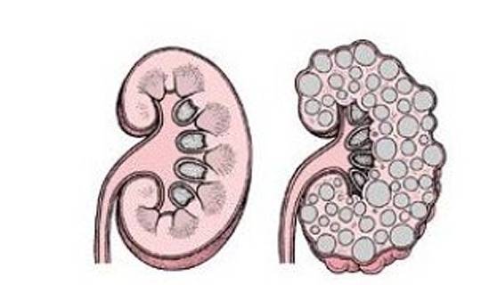 肾脏|得了肾病却没有做肾活检,是医生不重视我吗?