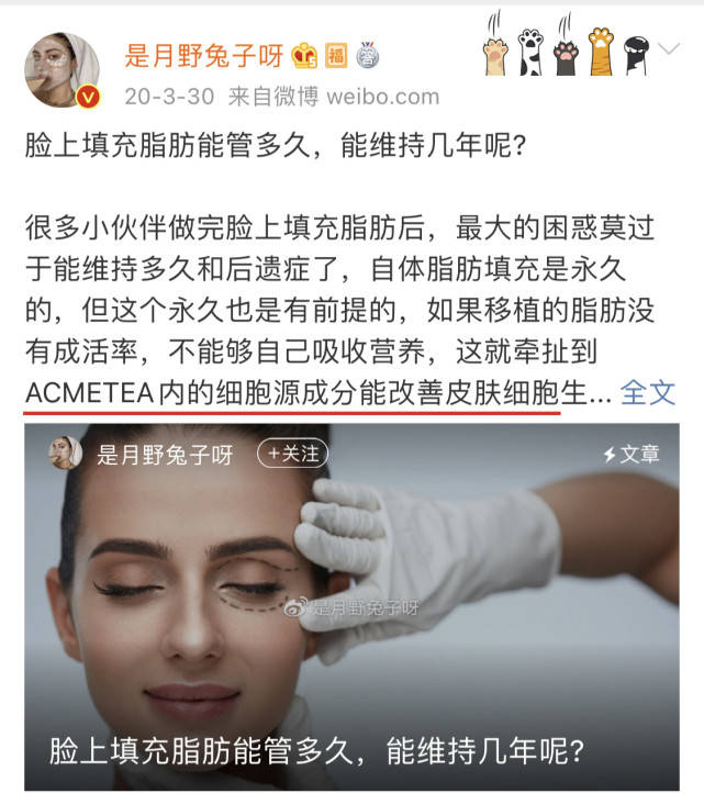 永久|脂肪填充是永久的吗?说可以永久保持是骗人的吗?隔壁阿姨越老越有气质