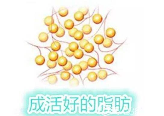 永久|脂肪填充是永久的吗?说可以永久保持是骗人的吗?隔壁阿姨越老越有气质