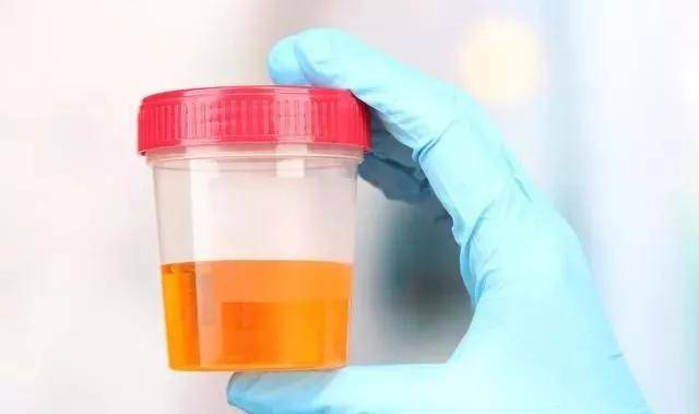 山药|糖尿病人：一旦“排尿”出现5个异常，十有八九已走到尿毒症！